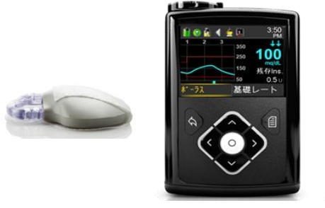 インスリンポンプ