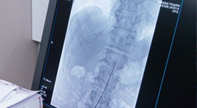 血管撮影装置で撮影した高精密度画像