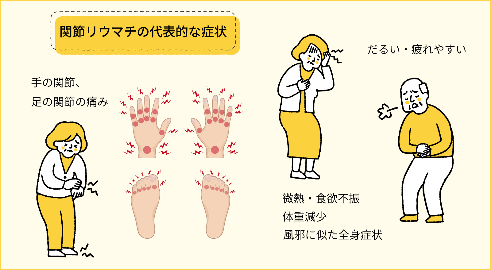 関節リウマチの代表的な症状のイラスト